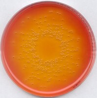 Deoxycholate lactose agar (for microbiology)