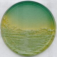 WL nutrient agar for microbiology